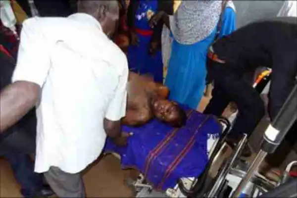 Too Bad! See How Man Poured Acid On His Wife For Delaying To Return Home After Visiting Her Parents